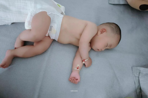 如东六个月宝宝眼睛散光